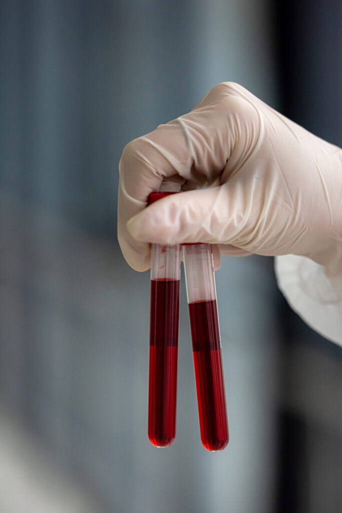 Blood Sample Collection