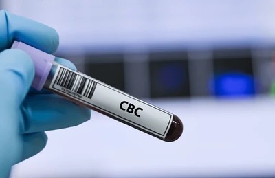CBC Test