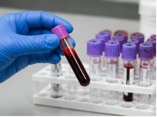 Complete Blood Test