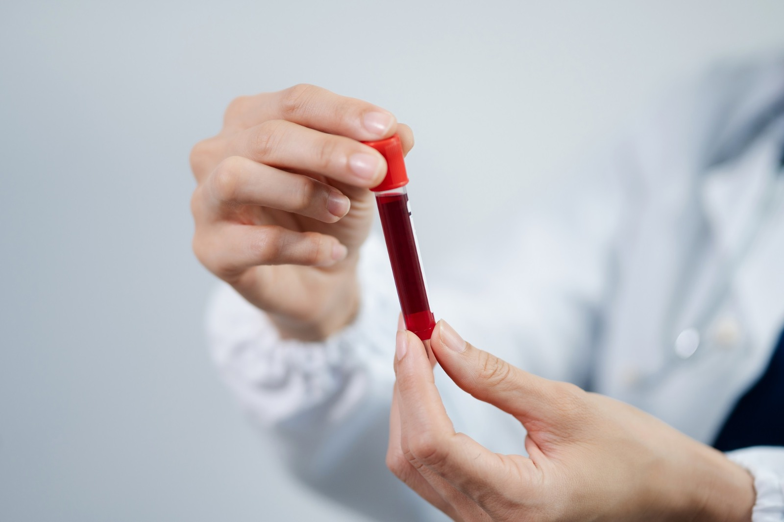 Kidney Function Test (KFT)