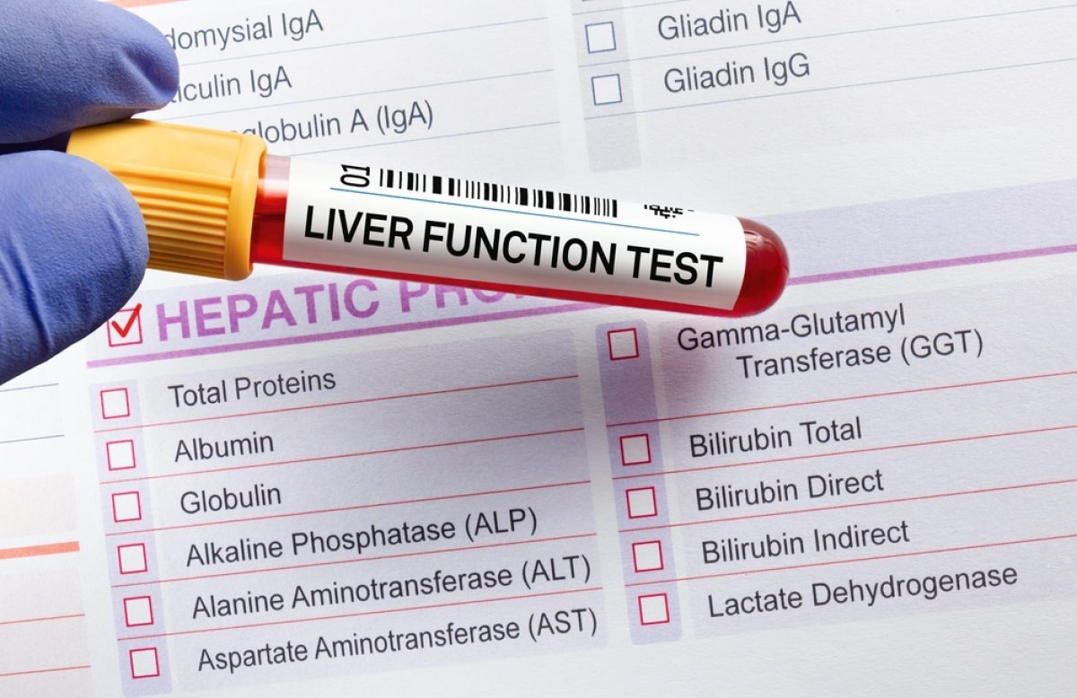 Liver Function Test (LFT)