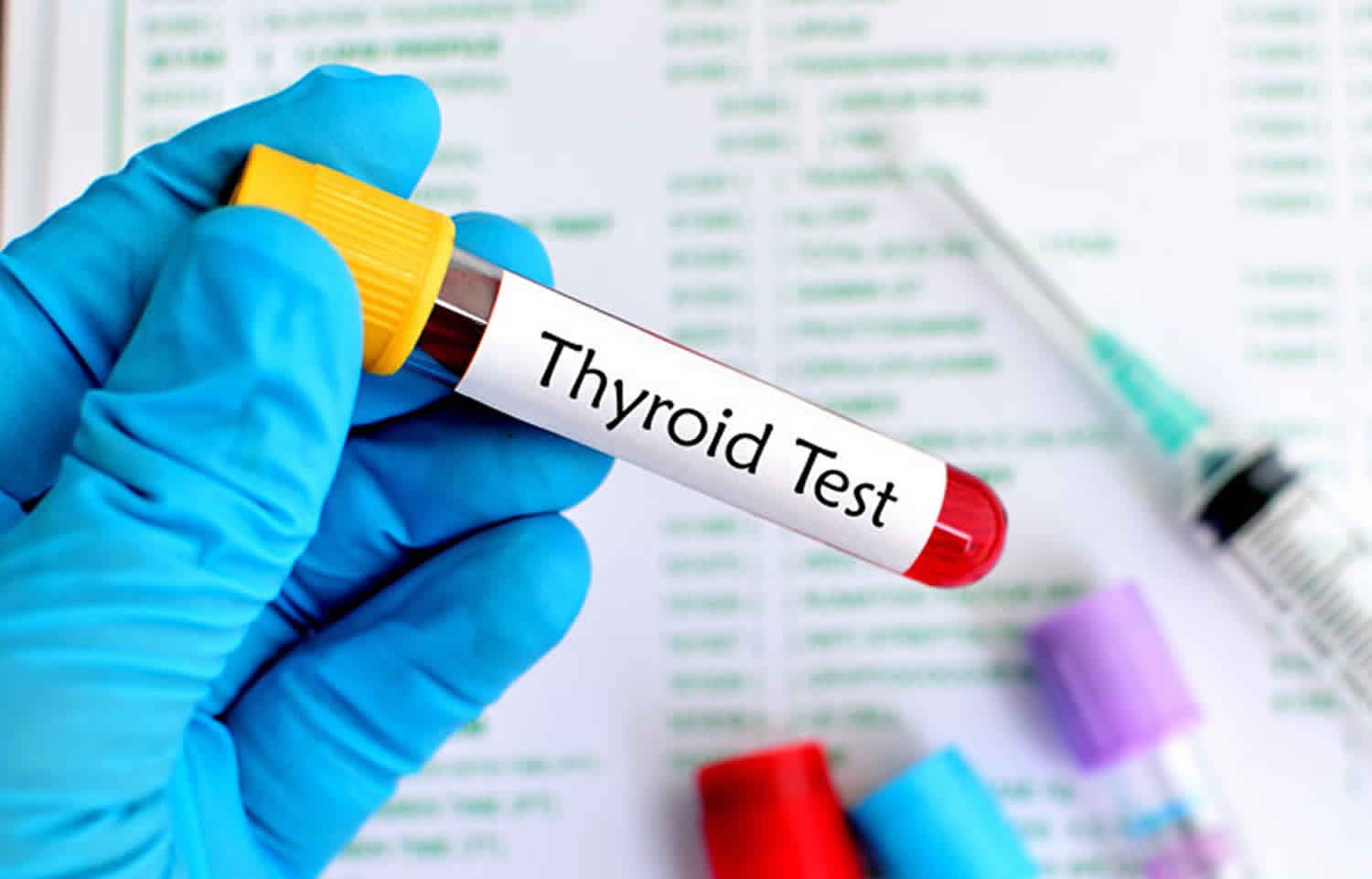 Thyroid Profile (TSH, T3, T4)