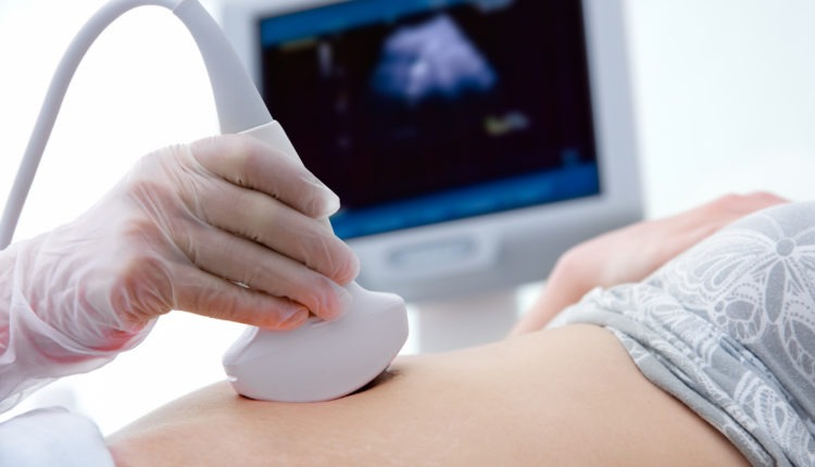 Ultrasound (USG)