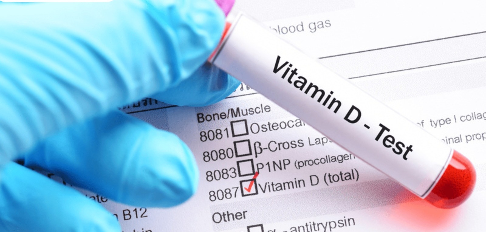 Vitamin D Test